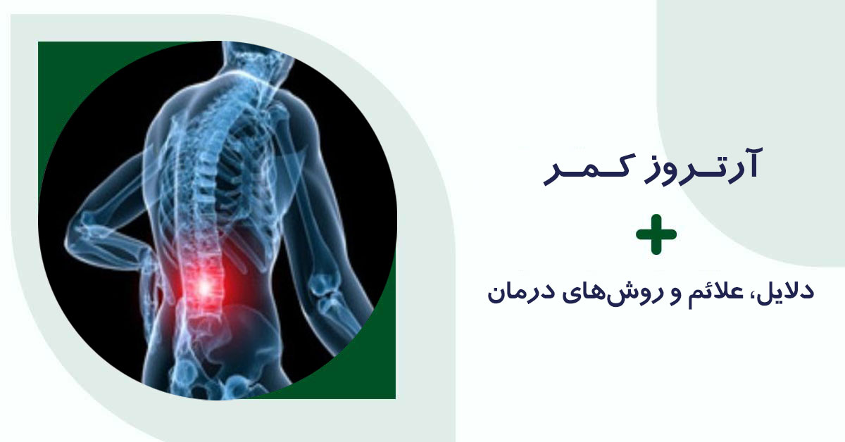 آرتروز کمر