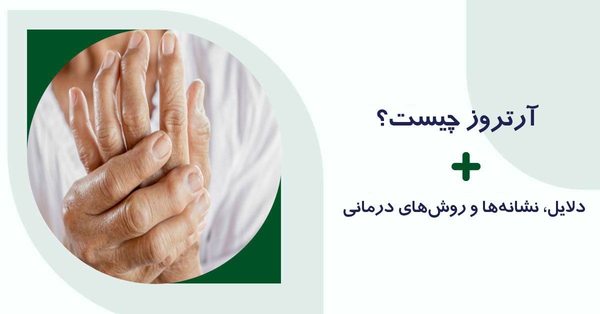 آرتروز چیست