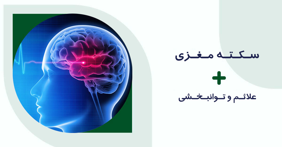 سکته مغزی: علائم و فیزیوتراپی آن