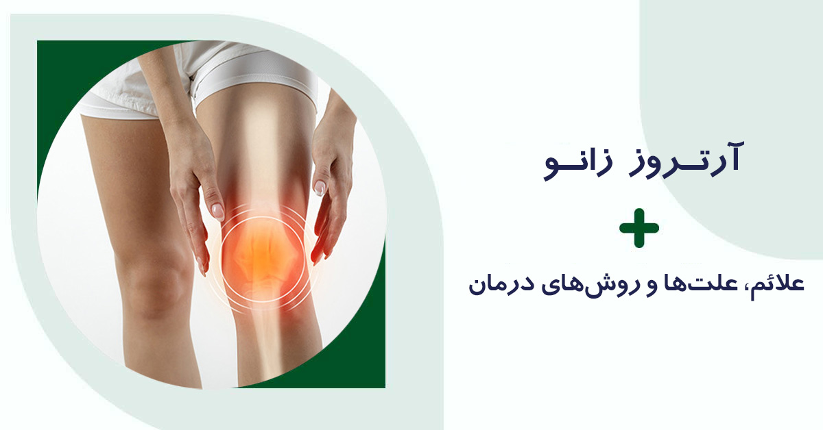 آرتروز زانو