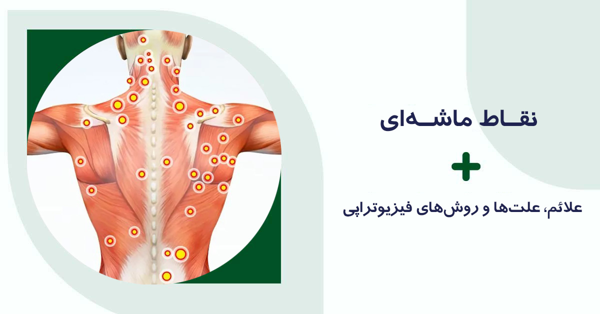 نقاط ماشه ای