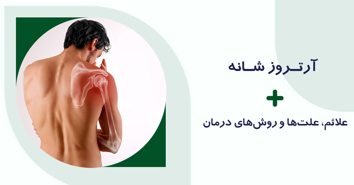 آرتروز شانه