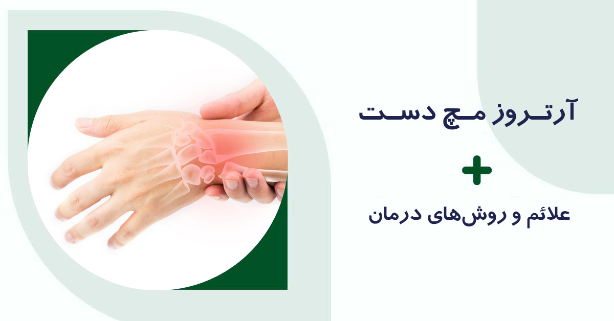 آرتروز مچ دست و روش های درمان آن