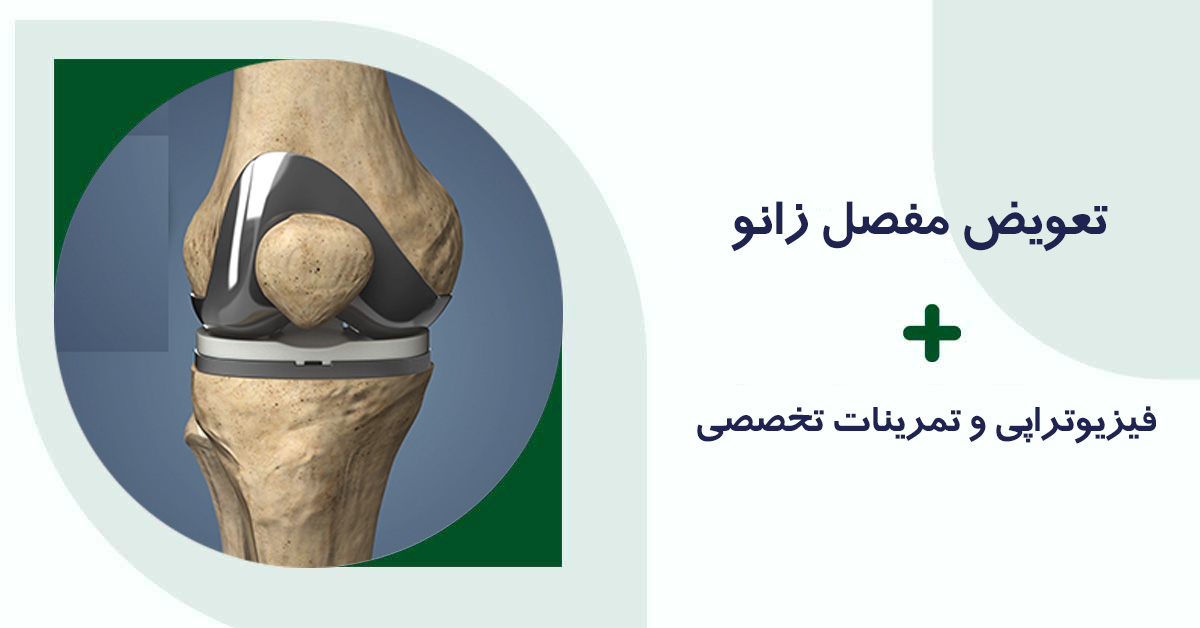 تعویض مفصل زانو