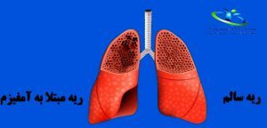 بیماری های مزمن ریوی و توانبخشی ریه