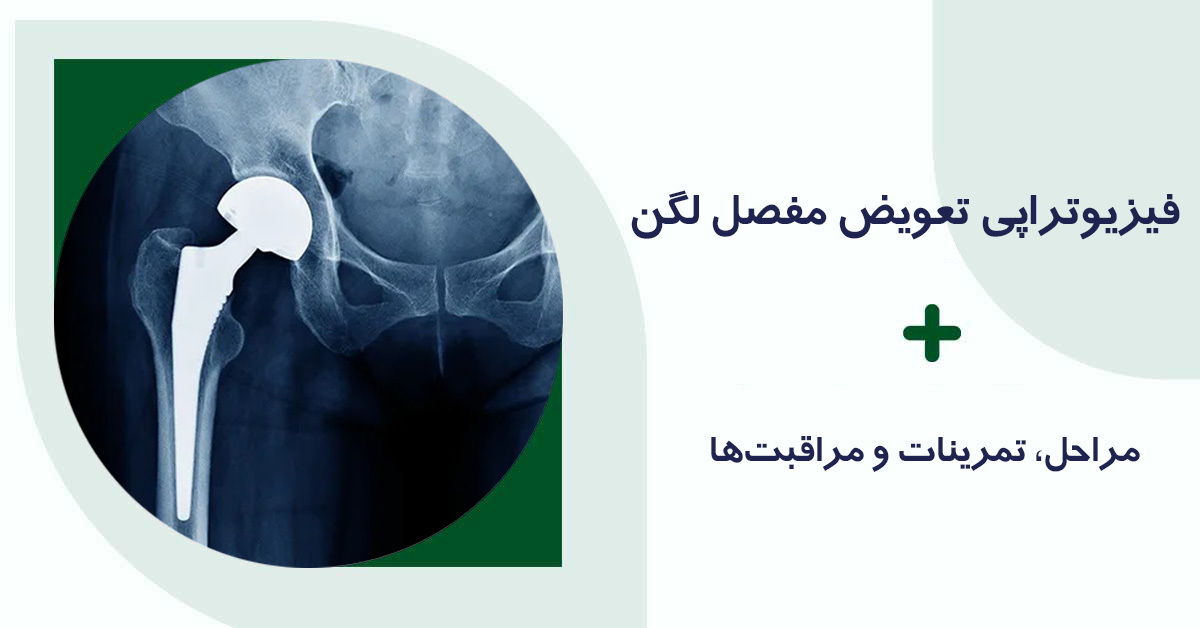 فیزیوتراپی تعویض مفصل لگن