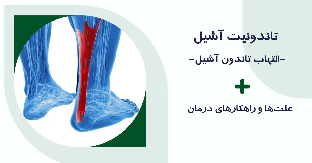 تاندونیت آشیل