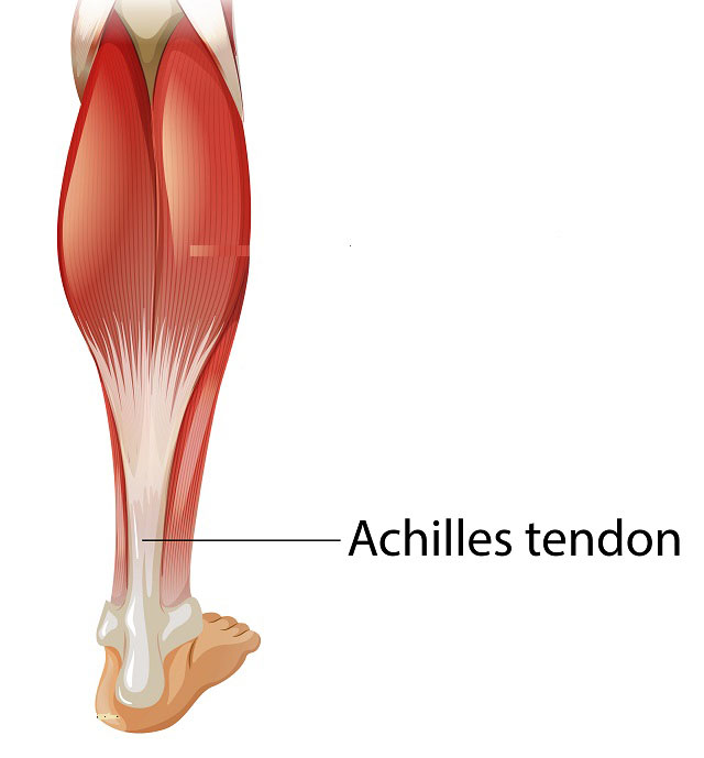 تاندون آشیل