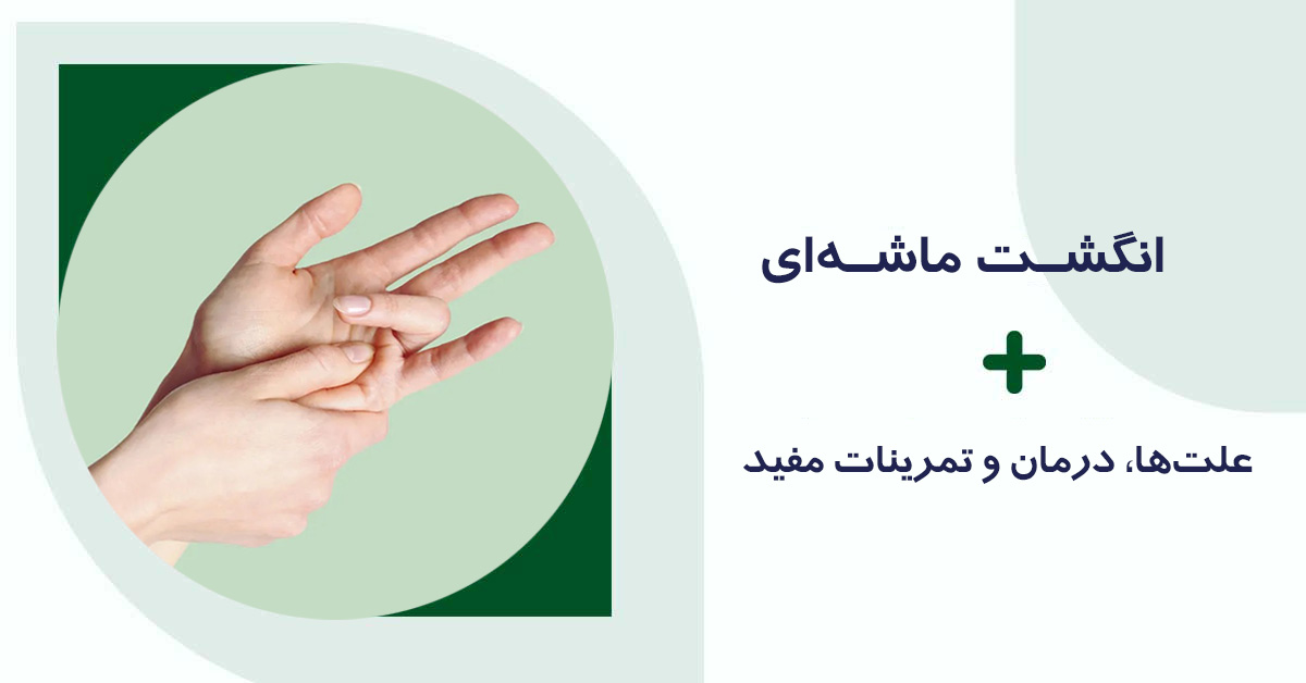 انگشت ماشه‌ای