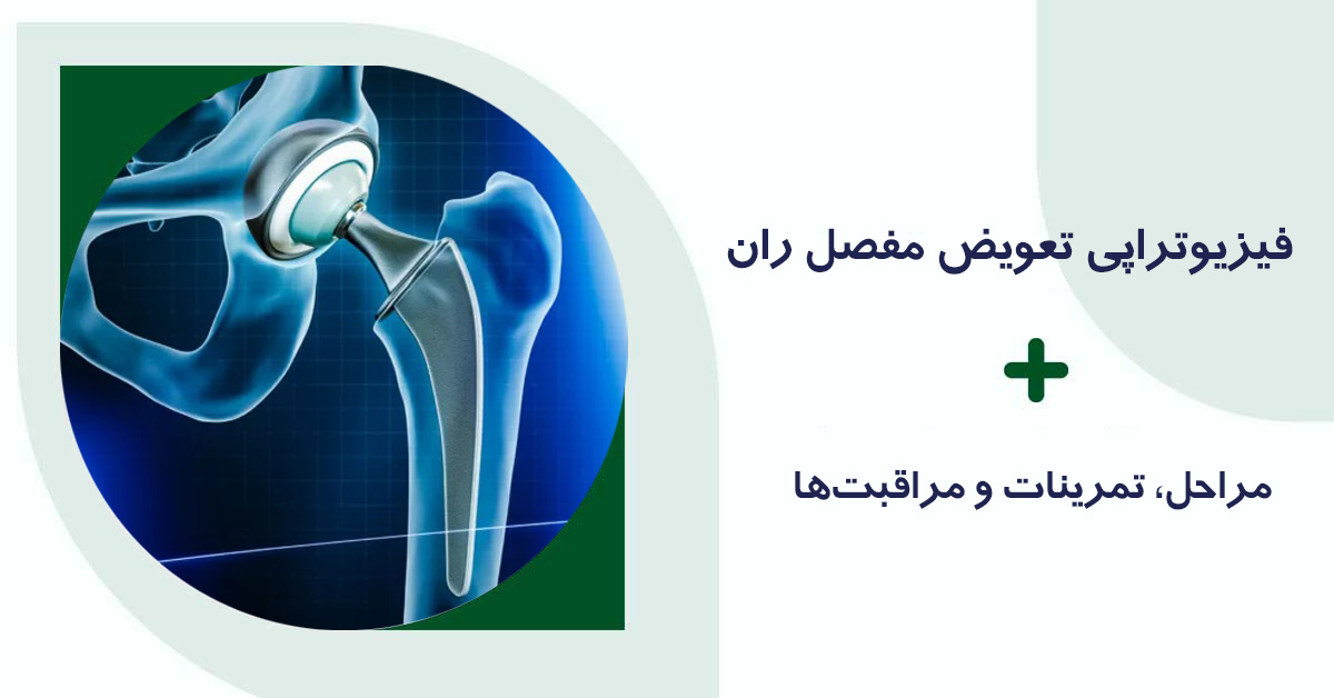 فیزیوتراپی تعویض مفصل ران