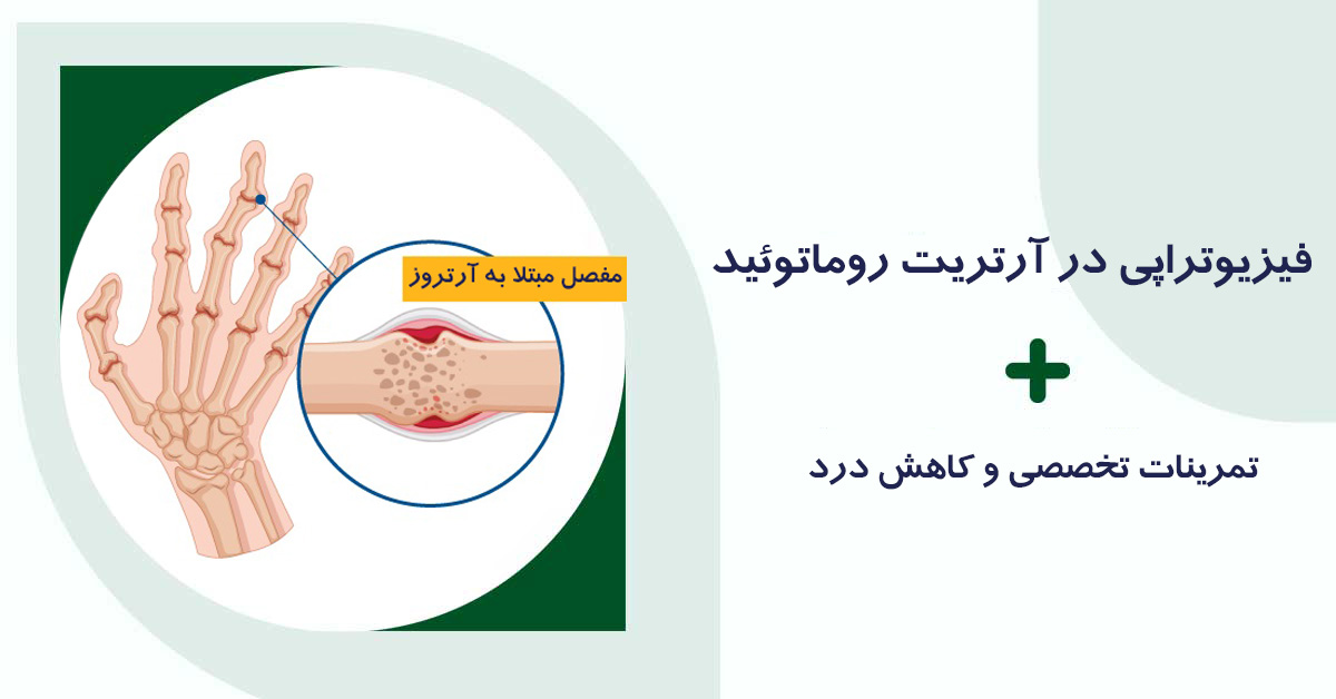 فیزیوتراپی در آرتریت روماتوئید