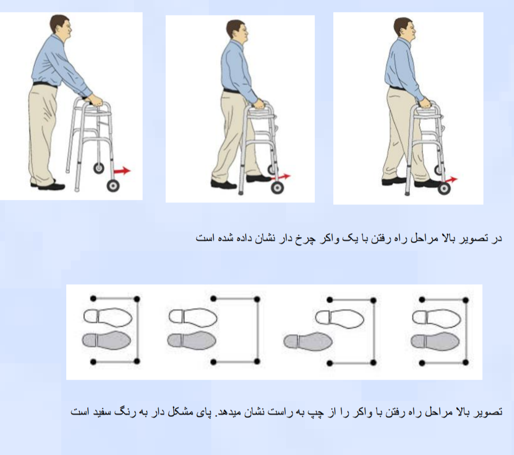 فیزیوتراپی بعد از عمل زانو در بیمارستان - تمرین روز اول 5-3