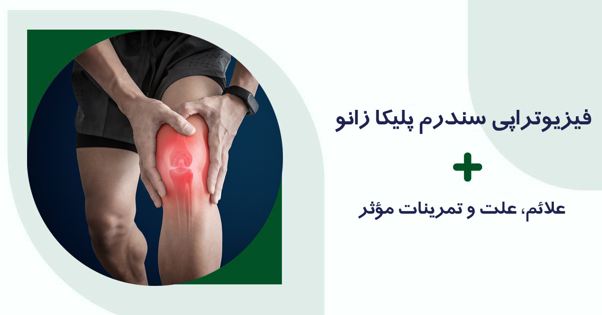 فیزیوتراپی سندرم پلیکا زانو
