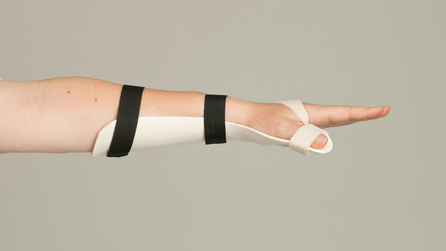 فیزیوتراپی پارگی تاندون اکستانسور دست