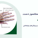 پارگی تاندون اکستانسور دست؛ بررسی کامل انواع آسیب و پروتکل‌های توانبخشی