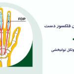 آسیب‌های تاندون فلکسور دست