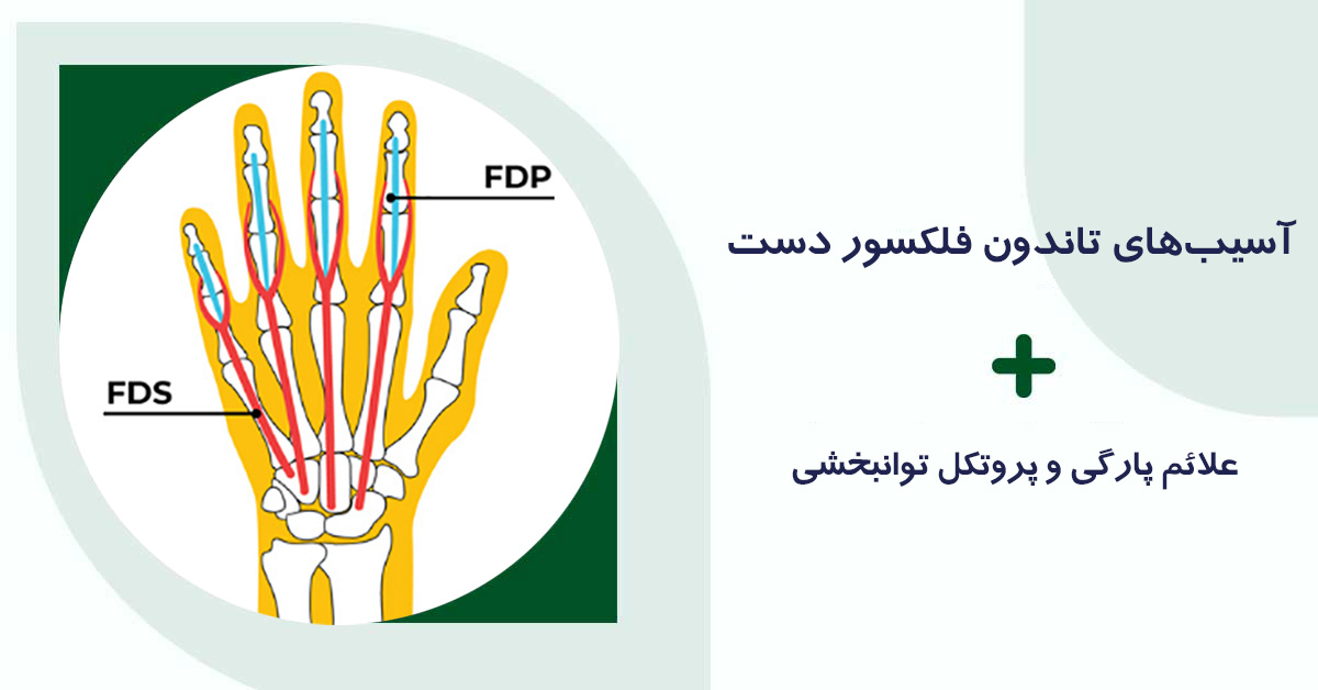 آسیب‌های تاندون فلکسور دست