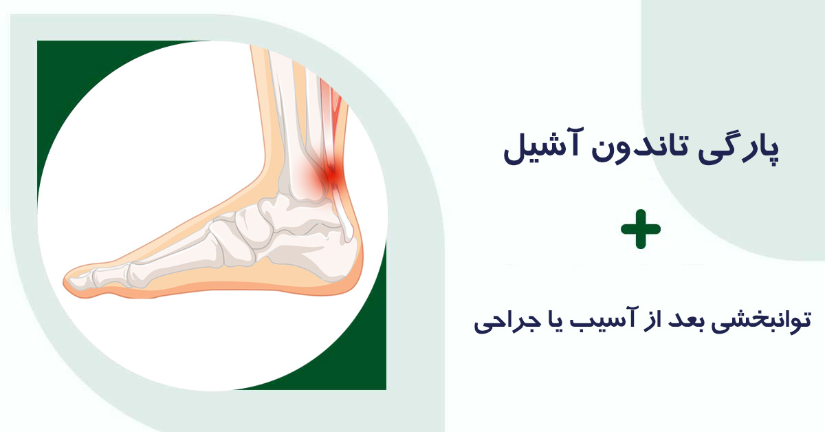 پارگی تاندون آشیل
